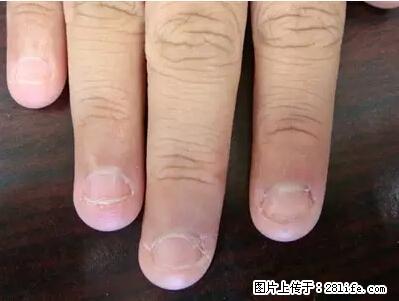 剪指甲、挖耳屎，这些日常小动作竟隐藏大危害！ - 秦皇岛生活资讯 - 秦皇岛28生活网 qhd.28life.com